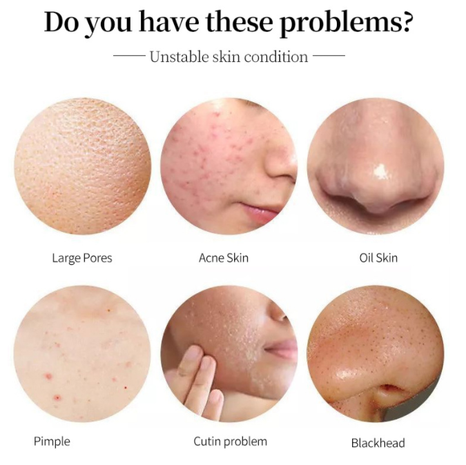 Skincare by Skin Type – How Brands Can Target Smarter and Choose the Right Factory