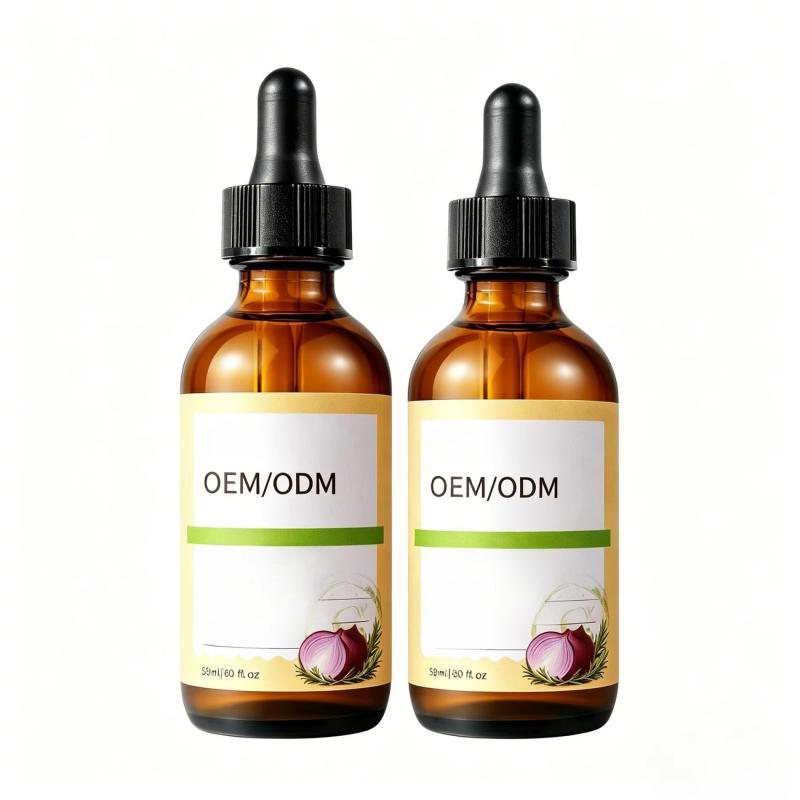 OEM Onion + Rosemary Hair Oil — Anti-Frizz, Smoothing & Scalp Care Treatment